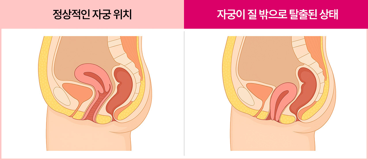 원장님